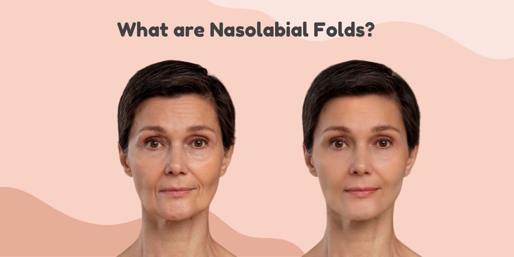 Nasolabial Folds Causes & Simple Fixes